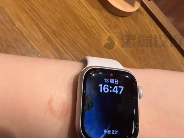 女子戴Apple Watch睡觉被烫伤起泡 苹果客服回应：过敏反应 - Apple Watch  (https://www.qianyan.tech/) 头条 第3张