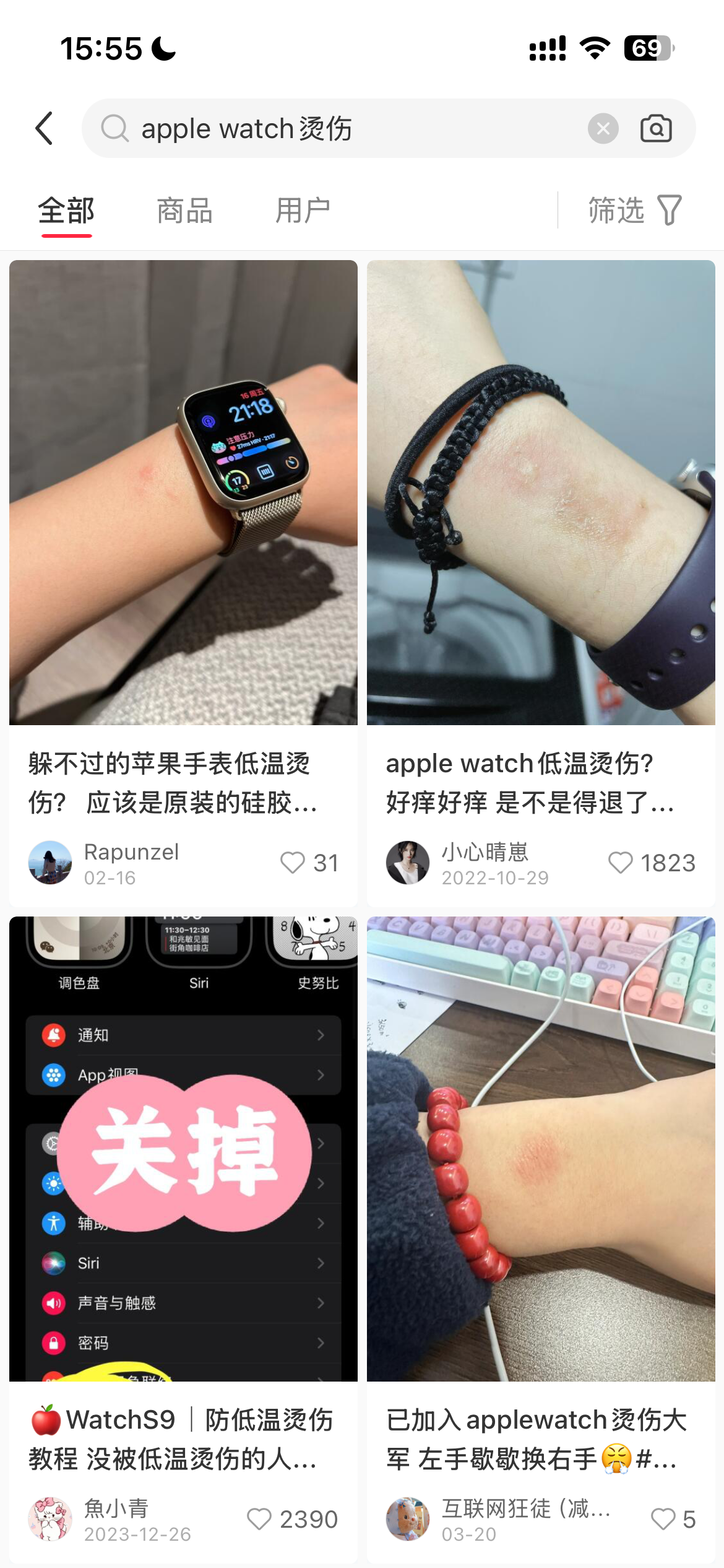 女子戴Apple Watch睡觉被烫伤起泡 苹果客服回应：过敏反应 - Apple Watch  (https://www.qianyan.tech/) 头条 第5张