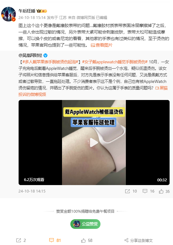 女子戴Apple Watch睡觉被烫伤起泡 苹果客服回应：过敏反应 - Apple Watch  (https://www.qianyan.tech/) 头条 第4张